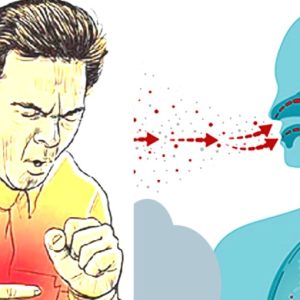 बर्दिबासमा क्षयरोगीको सङ्ख्या उच्च